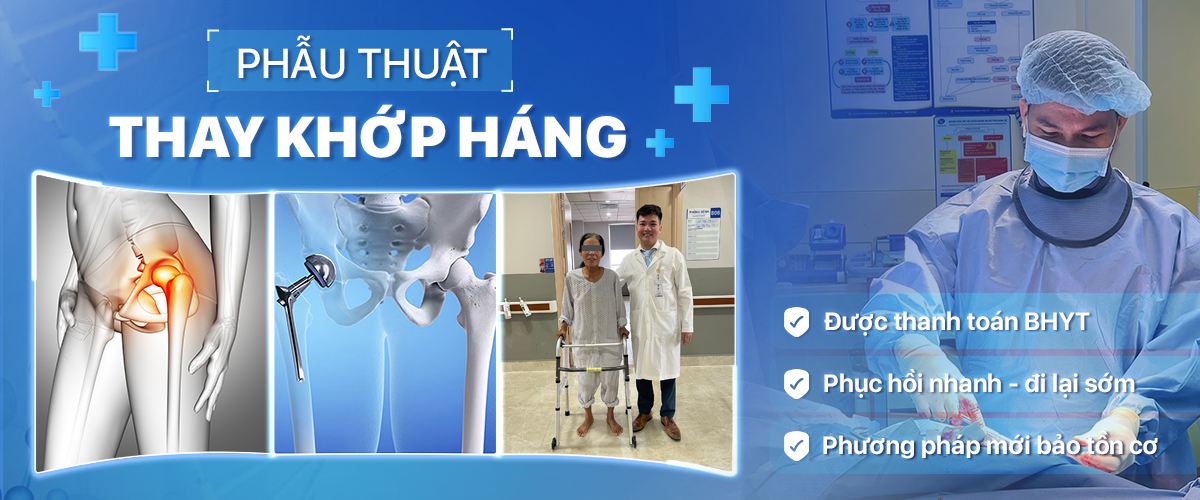 bs mổ thay khớp háng giỏi