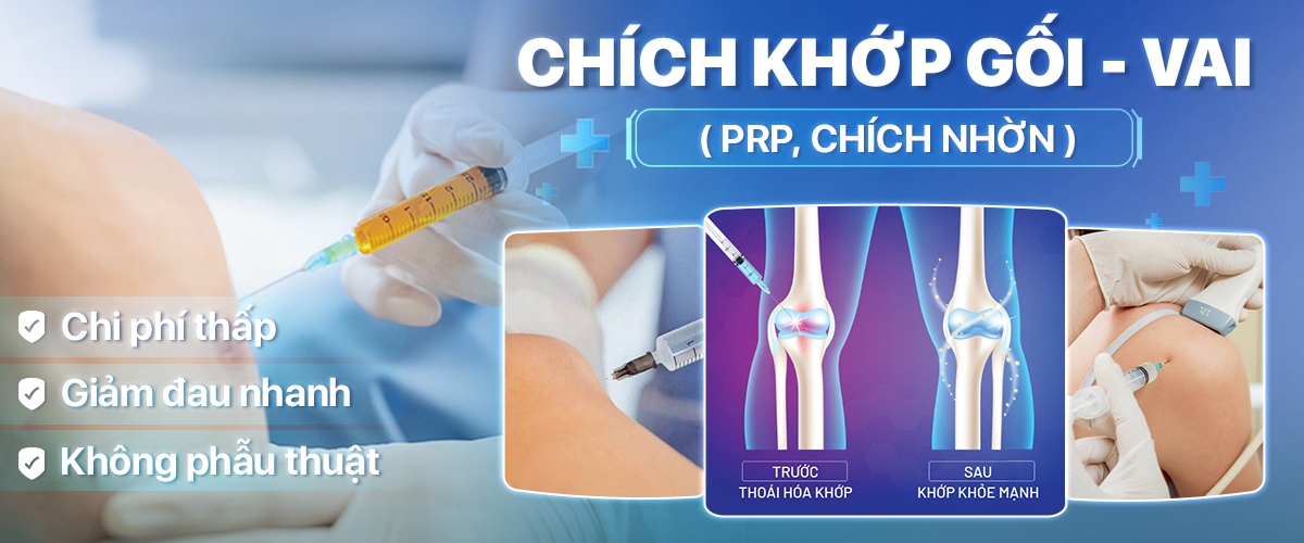 tiêm chất nhờn - prp khớp gối
